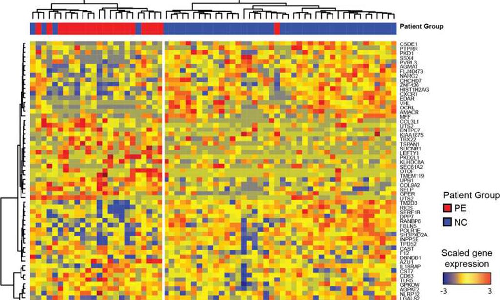 Image: Researchers identified an RNA signature in the blood of pregnant lupus patients that could help predict the development of preeclampsia (Photo courtesy of Medical Xpress).