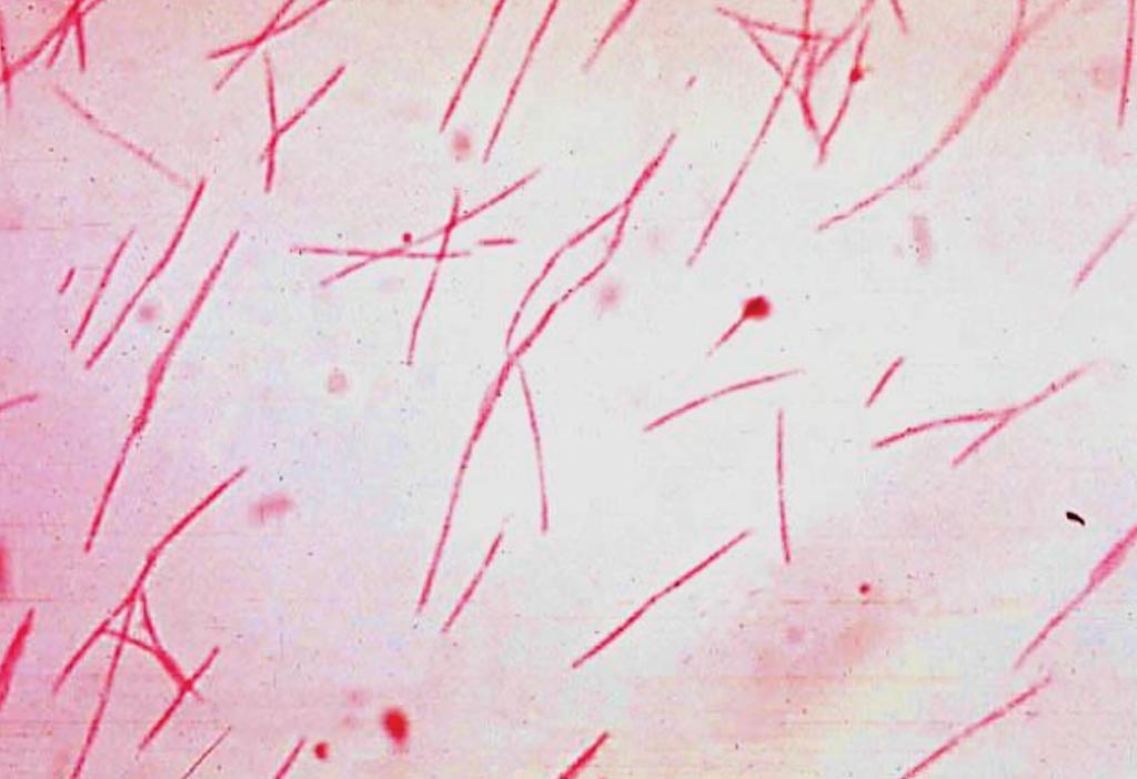 Image: A gram-negative stained culture of Fusobacterium nucleatum (Photo courtesy of J. Michael Miller, Ph.D., (D)ABMM).