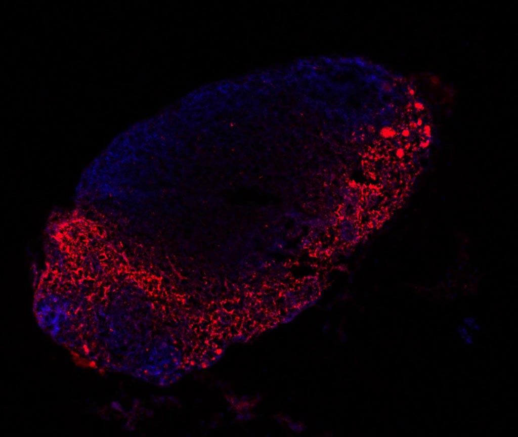 Image: The distribution of melanoma-derived exosomes (red) in mouse lymph nodes (blue) (Photo courtesy of Centro Nacional de Investigaciones Oncológicas).