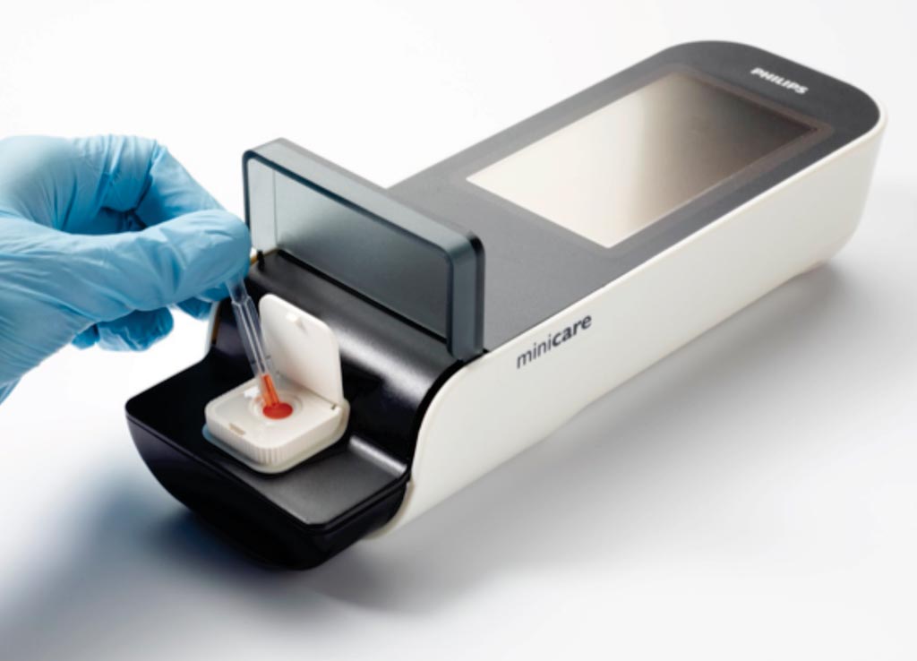 Image: The Minicare I-20 handheld diagnostics platform is designed to detect multiple target molecules at very low concentrations in a single ‘finger-prick’ blood sample, and display the results on a handheld analyzer within minutes (Photo courtesy of Philips Healthcare).
