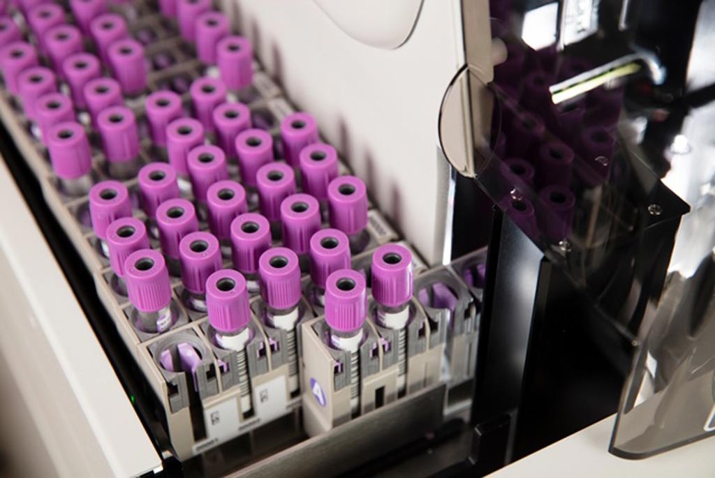 Image: The Early Sepsis Indicator kit was designed for use on automated hematology instruments such as the DxH 900 analyzer (Photo courtesy of Beckman Coulter).