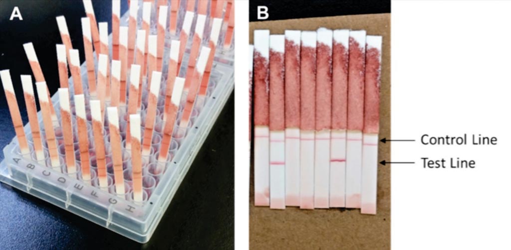 Image: A Pgp3 LFA-dipstick test. After approximately 4 hours, the LFA-dipstick was inserted into the well for 15 to 20 minutes, and then LFA buffer was added (A). LFAs were read when the membrane was completely cleared of background staining (B) (Photo courtesy of the CDC).