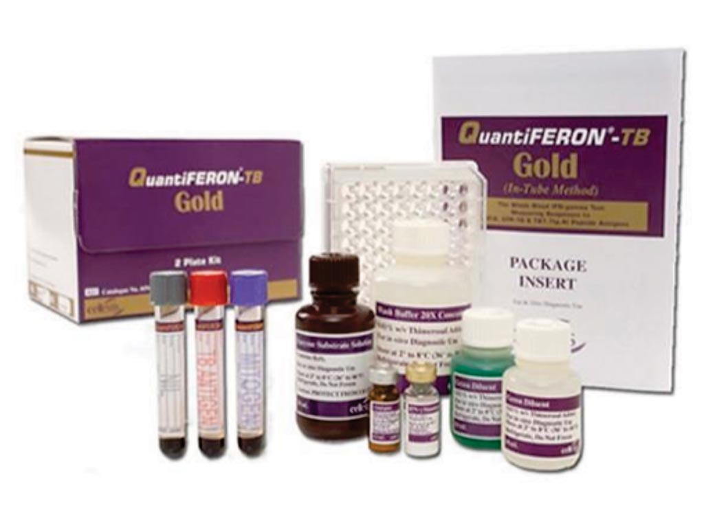 Image: QuantiFERON-TB Gold (QFT) is a simple blood test that aids in the detection of Mycobacterium tuberculosis, the bacteria which causes tuberculosis (TB). QFT is an interferon-gamma (IFN-γ) release assay, commonly known as an IGRA, and is a modern alternative to the tuberculin skin test (Photo courtesy of Qiagen).