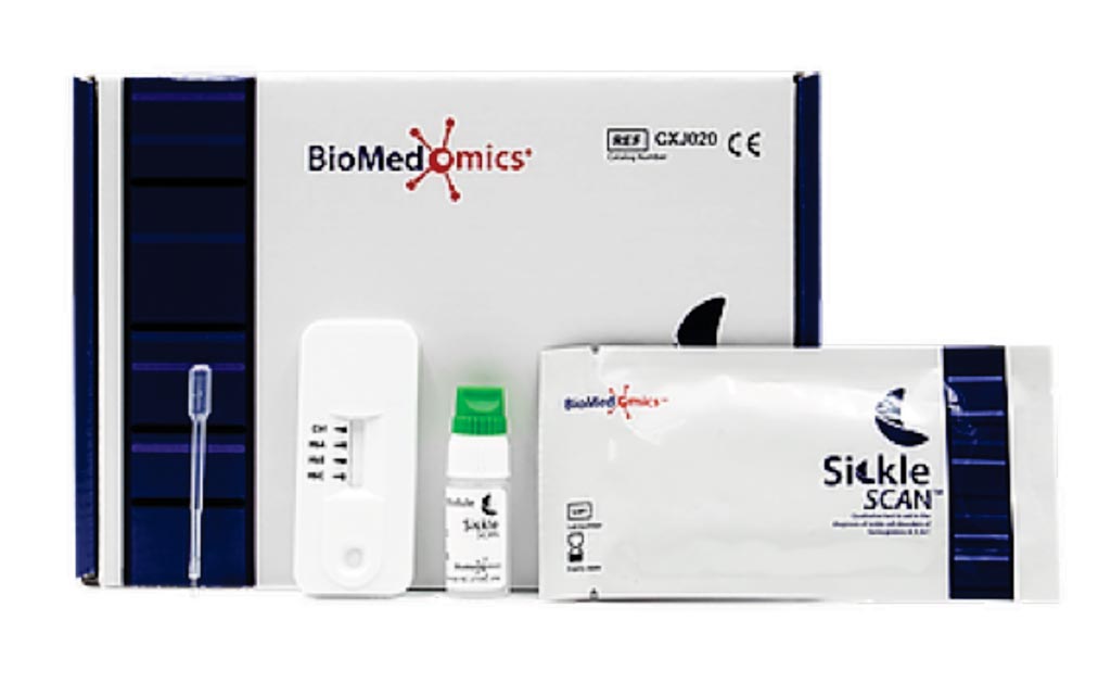 Image: Sickle SCAN is a multiplexed qualitative point-of-care immunoassay used for the rapid diagnosis of sickle cell disorders. The test is made up of three indicators which detect the presence of hemoglobin A, S, and C, allowing the user to rapidly distinguish between normal, carrier, and sickle cell samples (Photo courtesy of BioMedomics).