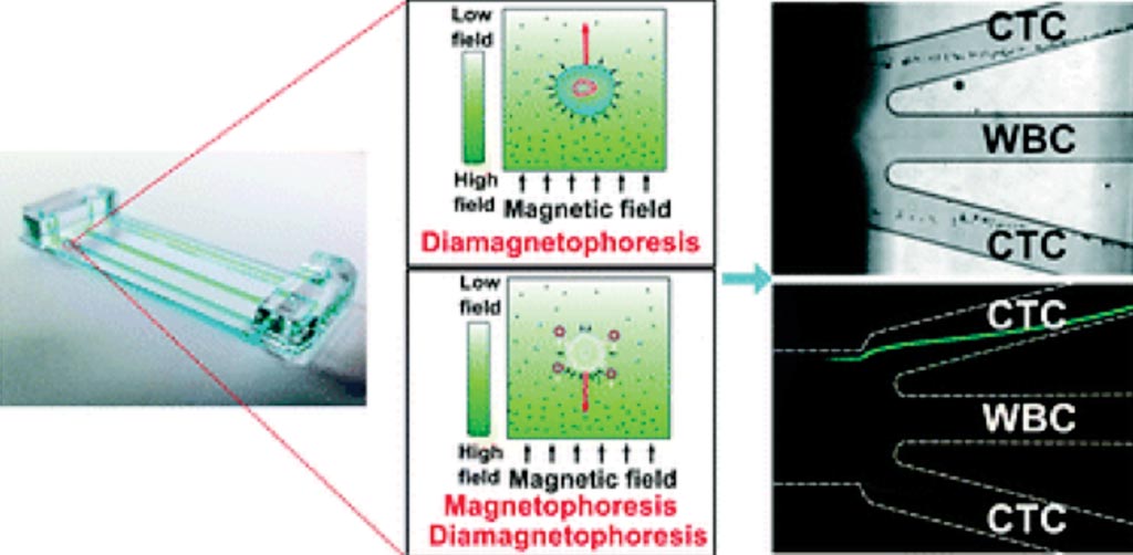 Image: The integrated ferrohydrodynamic cell separation (iFCS) device that enriches circulating tumor cells (CTCs) in a tumor antigen-independent and cell size variation-inclusive manner (Photo courtesy of the University of Georgia).