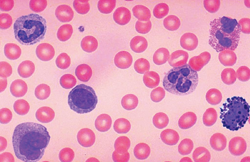 Image: A blood film showing typical red and white blood cells (Photo courtesy of Sherri Wick).
