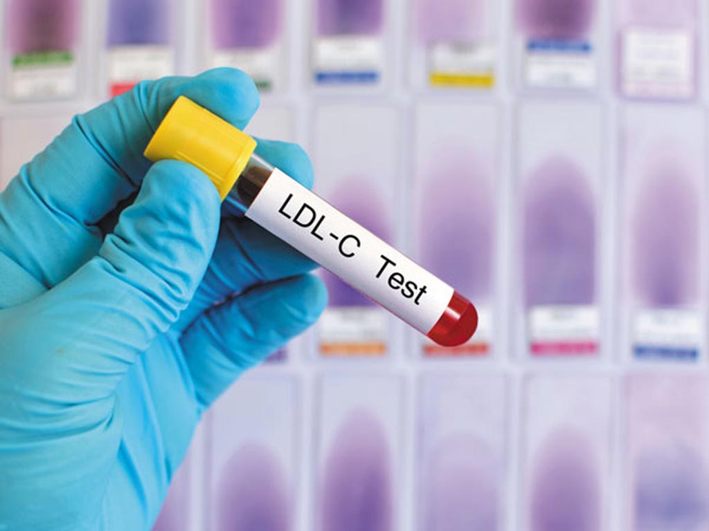 Image: A new study suggests fasting may not be necessary to ensure accurate test results when assessing CVD risk (Photo courtesy of Harvard Medical School).