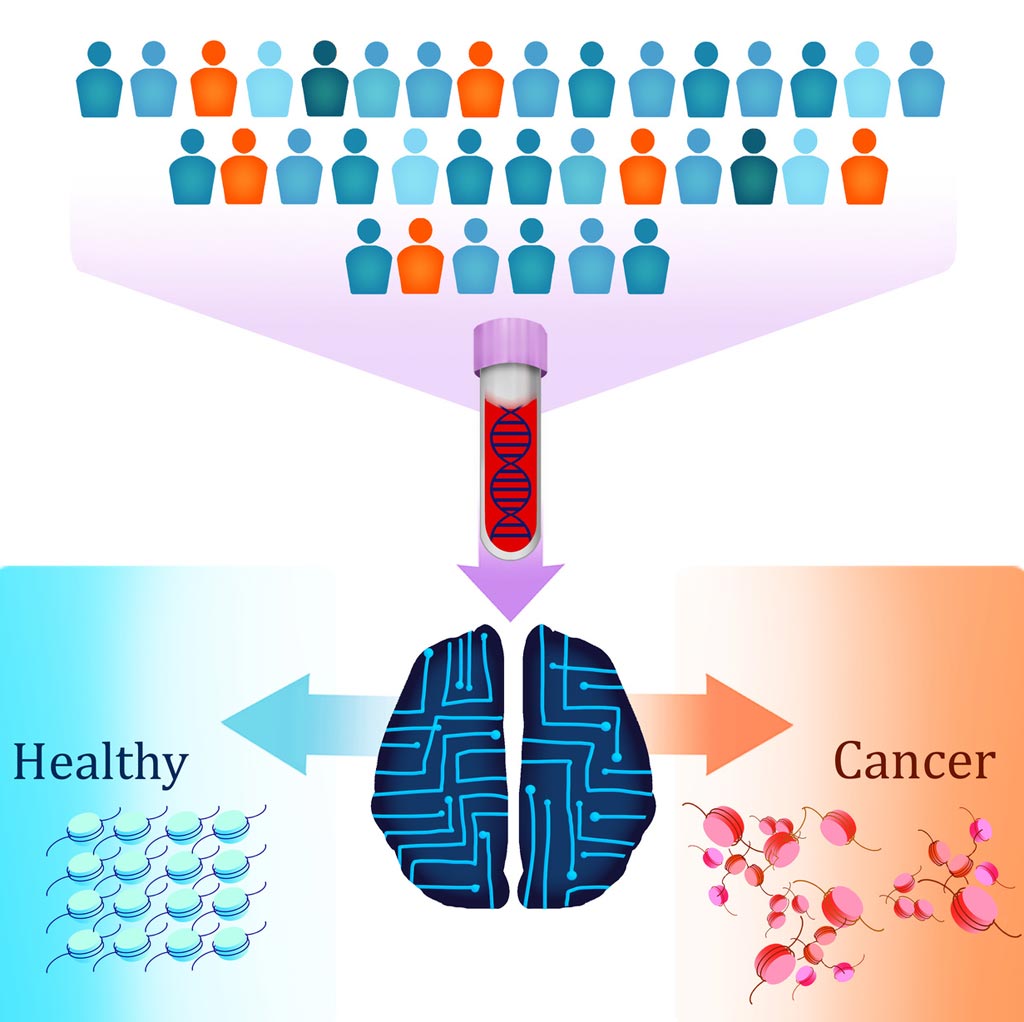 Image: A new liquid biopsy test called DELFI (DNA evaluation of fragments for early interception) uses artificial intelligence to detect patients with cancer by identifying altered DNA fragmentation in the blood (Photo courtesy of Carolyn Hruban, Johns Hopkins University).