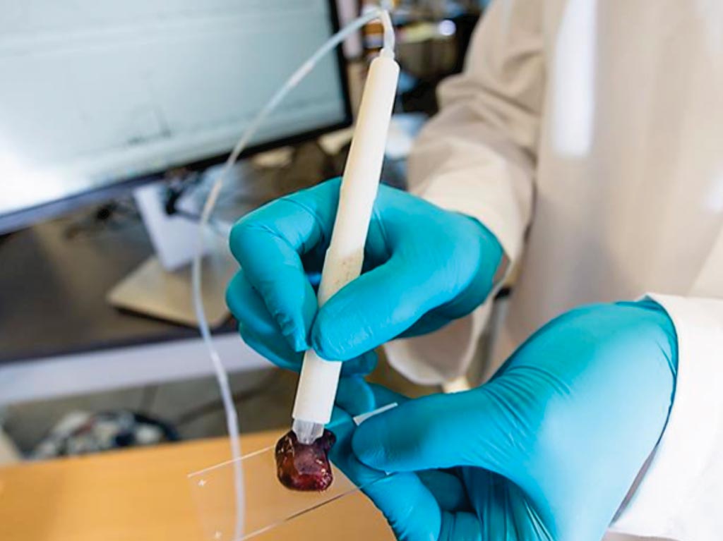The handheld MasSpec Pen device which can be connected to a Mass Spectrometer for diagnosing ovarian and other cancers (Photo courtesy of the University of Texas at Austin).