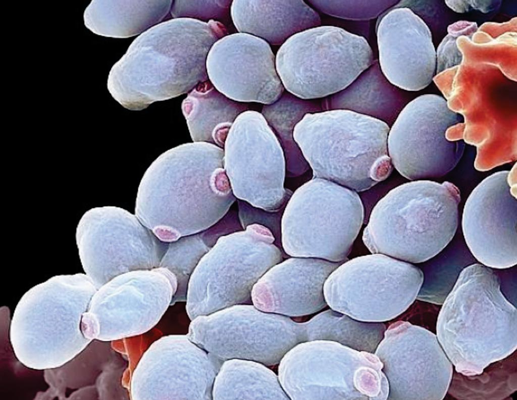 Image: A scanning electron photomicrograph of Candida albicans yeast cells (Photo courtesy of Science Photo Library).