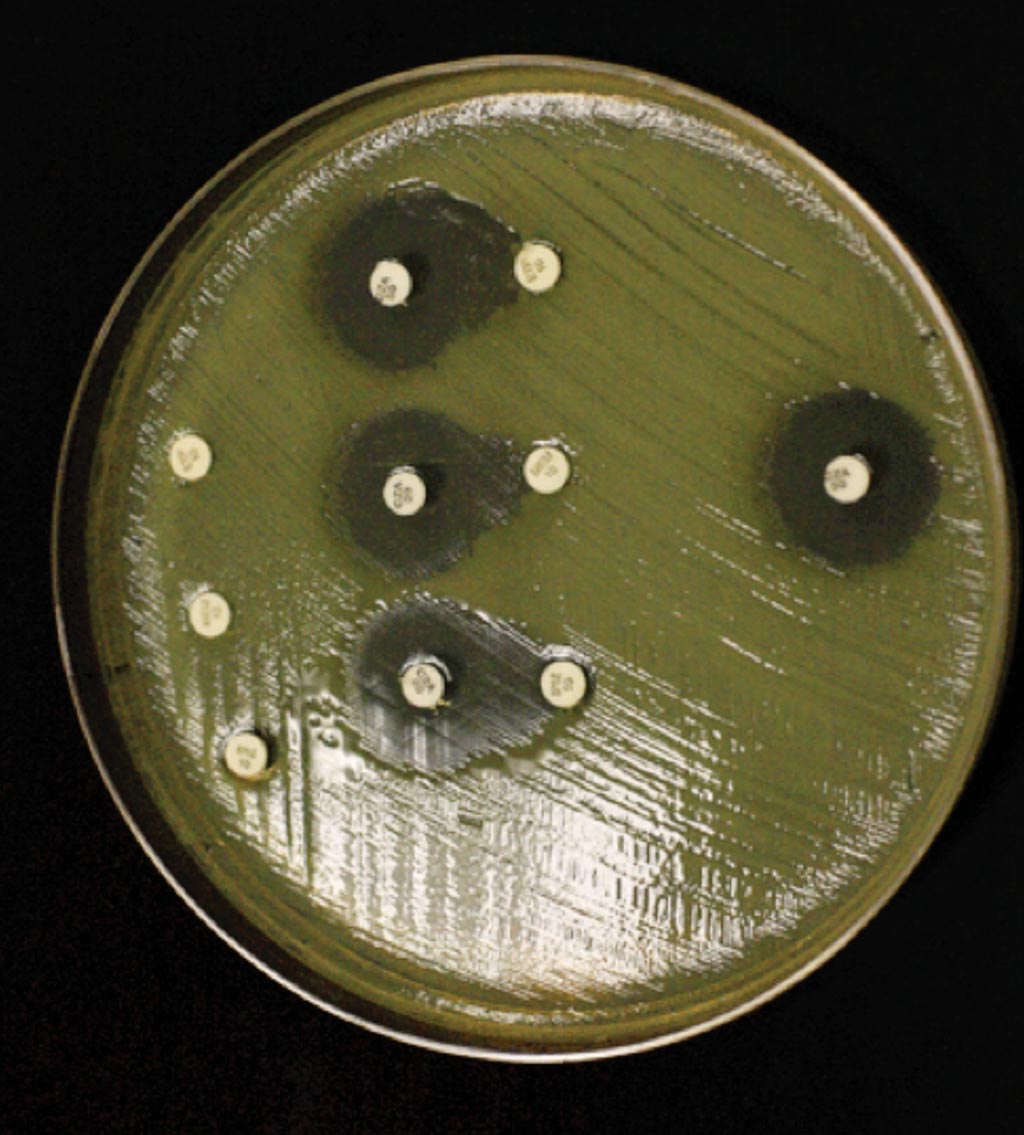 Image: Carbapenem disc diffusion susceptibility testing of the pandrug-resistant isolate of carbapenem-resistant Klebsiella pneumoniae in a Mueller-Hinton agar. In the center are three sets of discs of ertapenem, meropenem, and imipenem (top to bottom) alongside ceftazidime-avibactam (Photo courtesy of University of Miami).