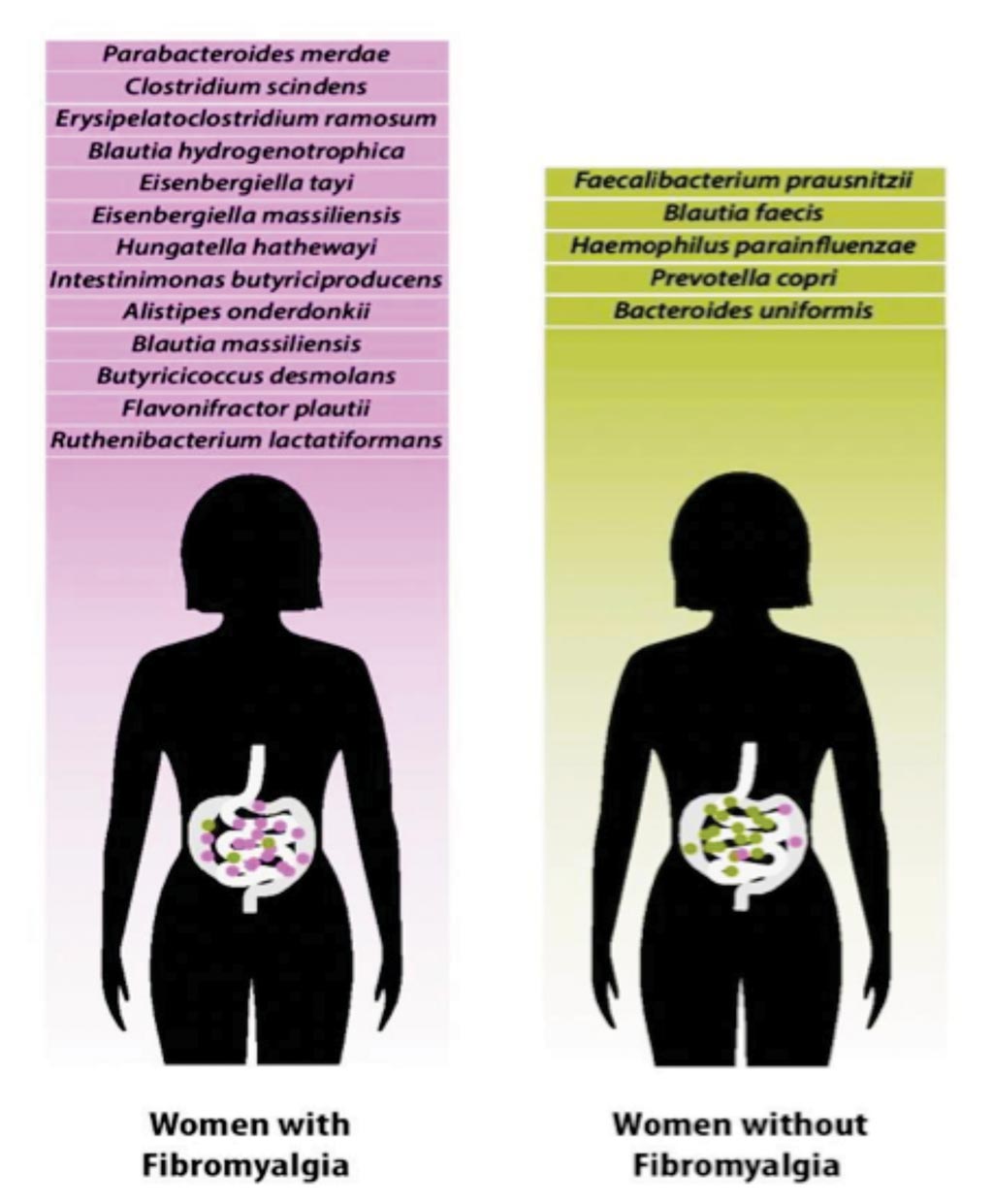 Image: Research shows fibromyalgia patients may have a distinct composition of gut microbiome species (Photo courtesy of Christopher Bergland).