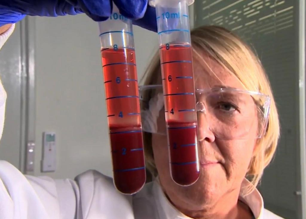 Image: A researcher preparing blood samples for Actiphage testing (Photo courtesy of the University of Nottingham, School of Bioscience).