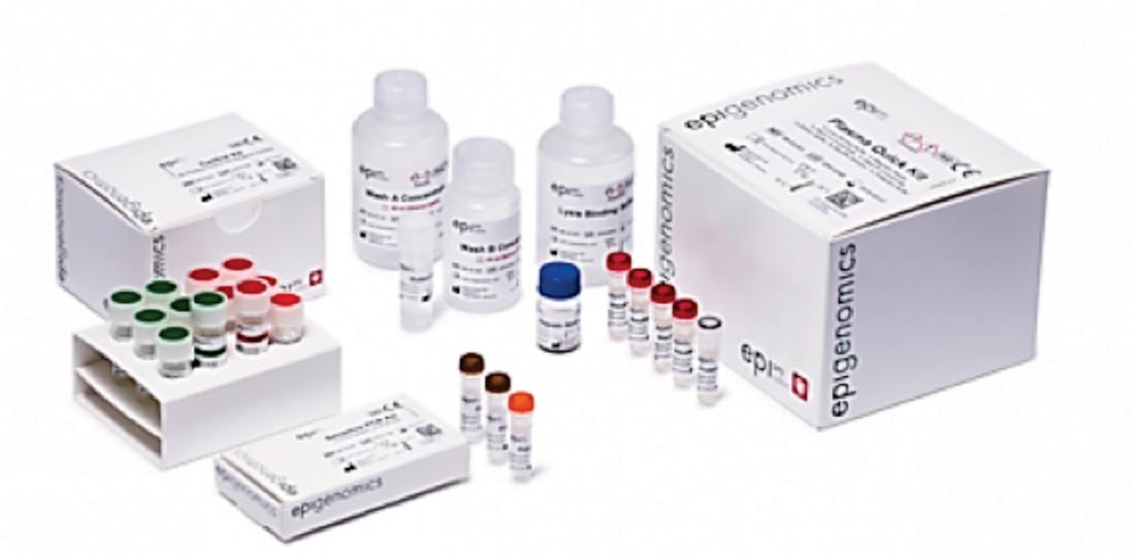 Image: The Epi ProColon screening test is a blood-based colorectal cancer screening test is an in vitro polymerase chain reaction assay for the qualitative detection of Septin9 gene methylation in DNA isolated from the patient’s plasma (Photo courtesy of Epigenomics).