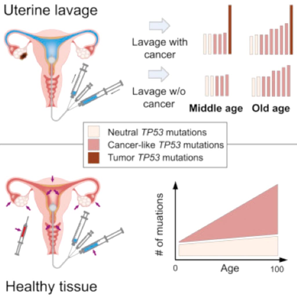 Image: Ultra-Sensitive TP53 sequencing for cancer detection reveals progressive clonal selection in normal tissue over a century of human lifespan (Photo courtesy of University of Washington).