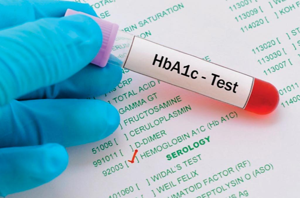 Image: The glycated hemoglobin (HbA1c) blood test gives an average level of blood sugar over the past two to three months (Photo courtesy of HealthEngine).