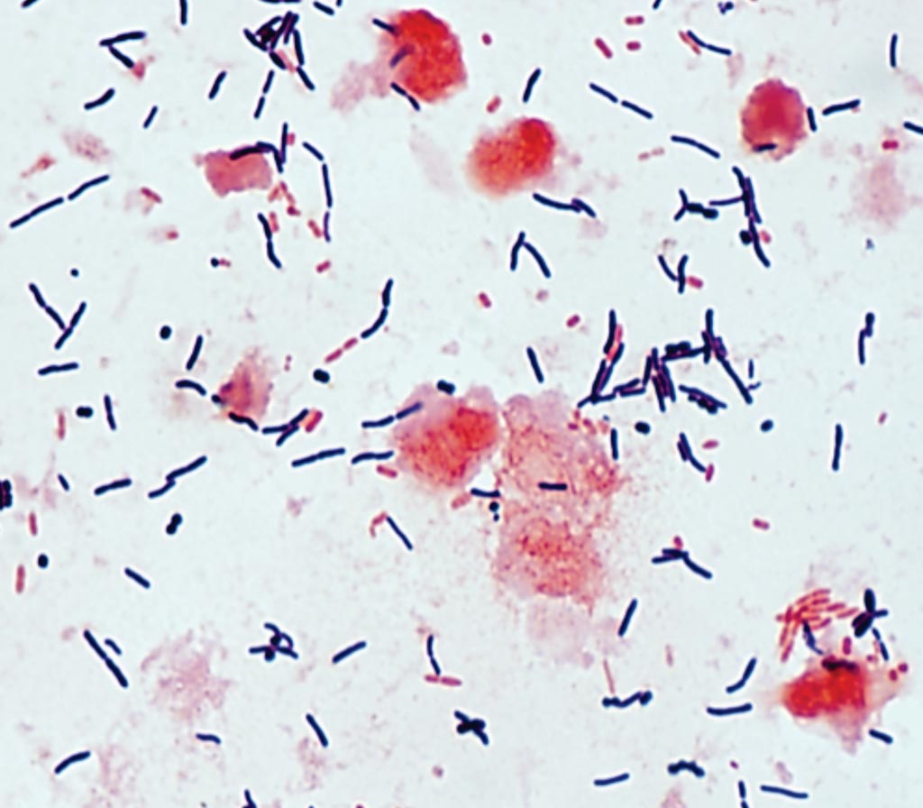 clostridium difficile spore stain