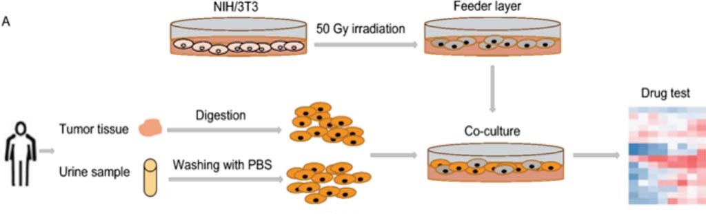 Image: A diagram of the workflow of the conditional reprogramming (CR) method for collection of urine and tissue samples and establishment of primary bladder cancer cell cultures (Photo courtesy of Fudan University).