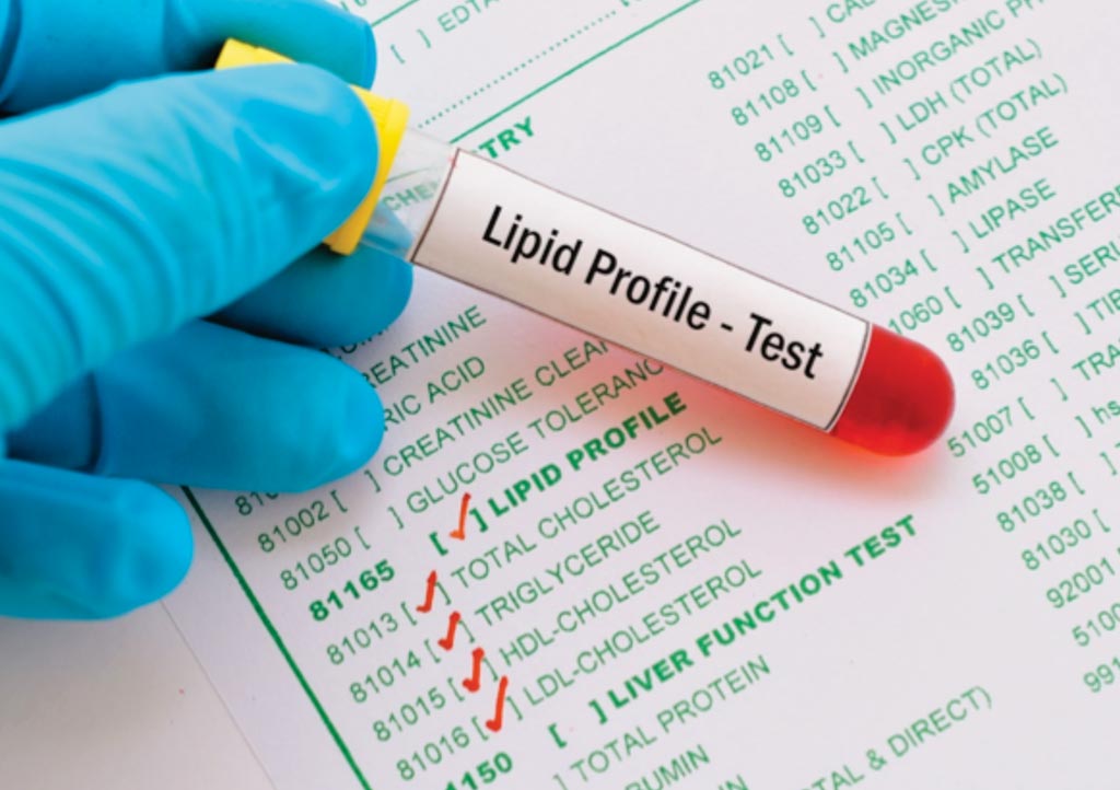 Image: Scientists determined that one-third of total cholesterol in plasma was present in remnant lipoproteins, which is in the triglyceride-rich lipoproteins intermediate-density lipoprotein (IDL) and very low-density lipoprotein (VLDL) (Photo courtesy of Harvard Medical School).