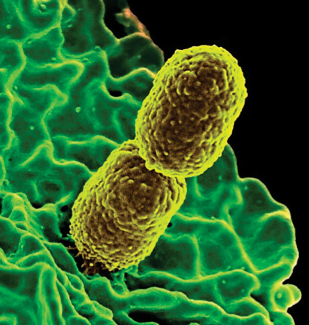 Image: A scanning electron micrograph of two rod-shaped bacteria called Klebsiella pneumoniae that are resistant to treatment with the “last resort” antibiotic drug called carbapenem. In this image, the mustard-colored bacteria are interacting with the green-colored human white blood cells (Photo courtesy of National Institute of Allergy and Infectious Diseases).