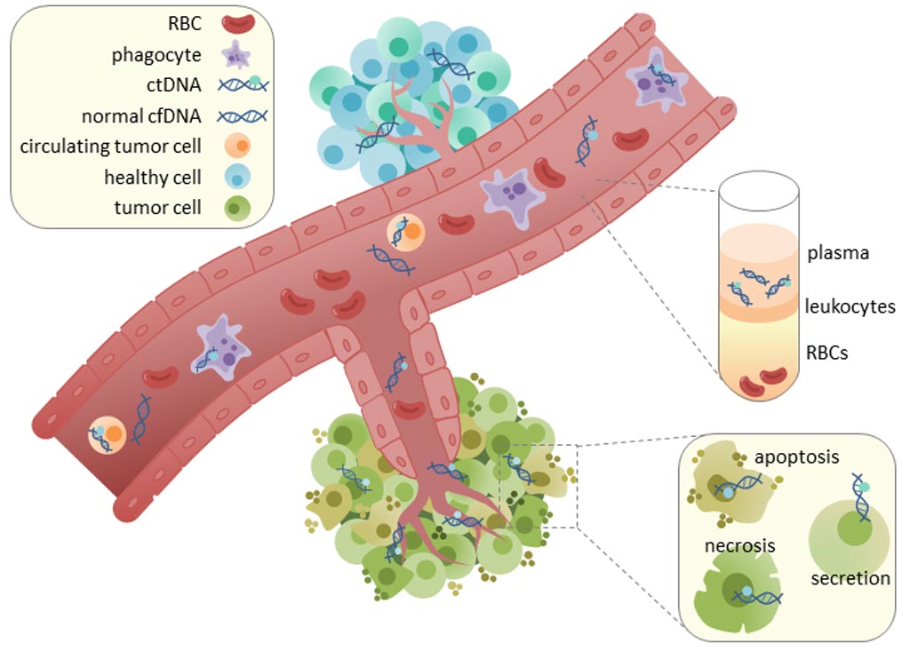 Image: Circulating tumor DNA (ctDNA) is found in serum and plasma fractions from blood. The mechanism of ctDNA release is unknown, though apoptosis, necrosis, and active secretion from tumor cells have been hypothesized (Photo courtesy of Wikimedia Commons).