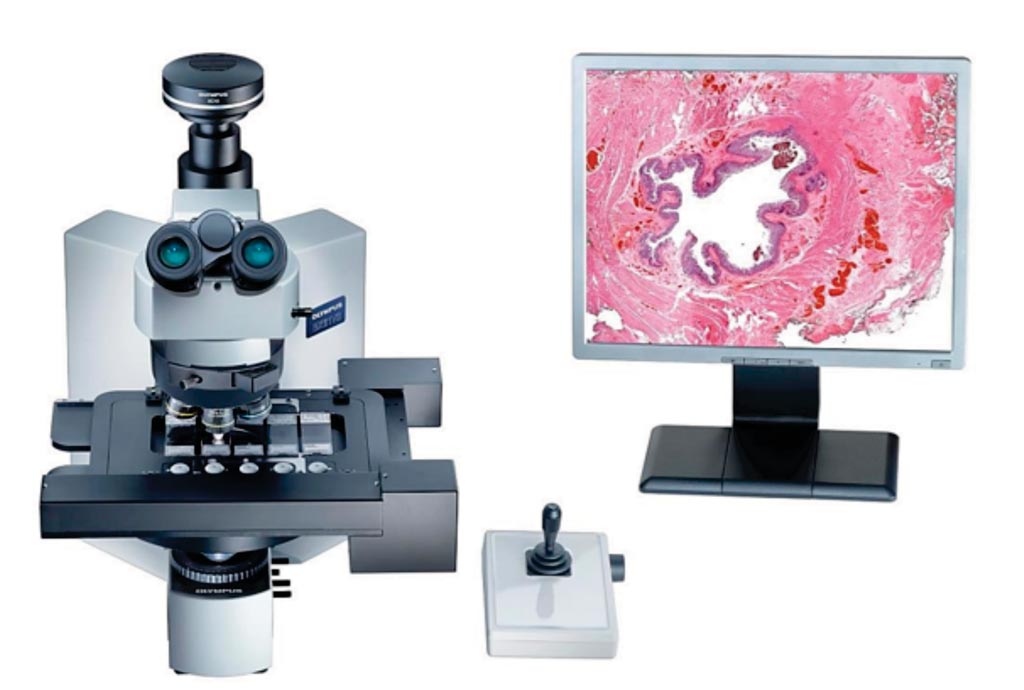 Image: The VS110 combines microscopy seamlessly with imaging to create a virtual slide that is an exact copy of the real specimen (Photo courtesy of Olympus).