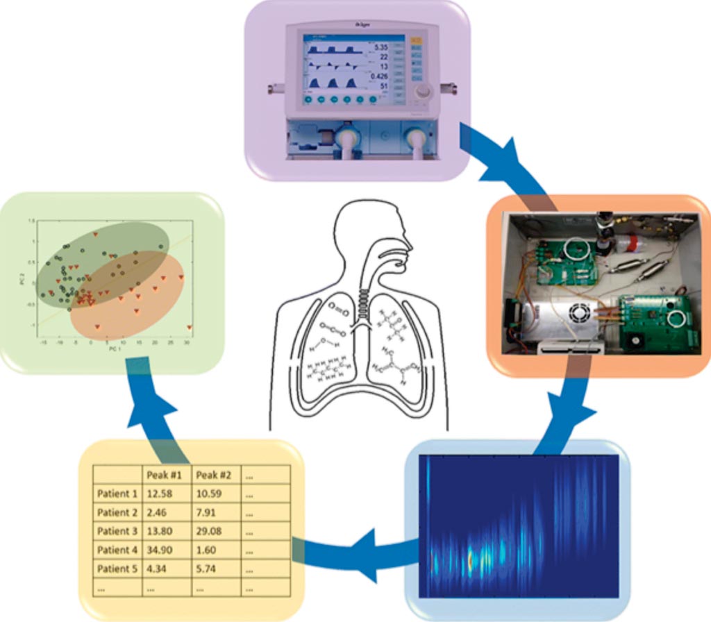 Image: Rapid breath analysis for acute respiratory distress syndrome diagnostics using a portable two-dimensional gas chromatography device (Photo courtesy of University of Michigan).