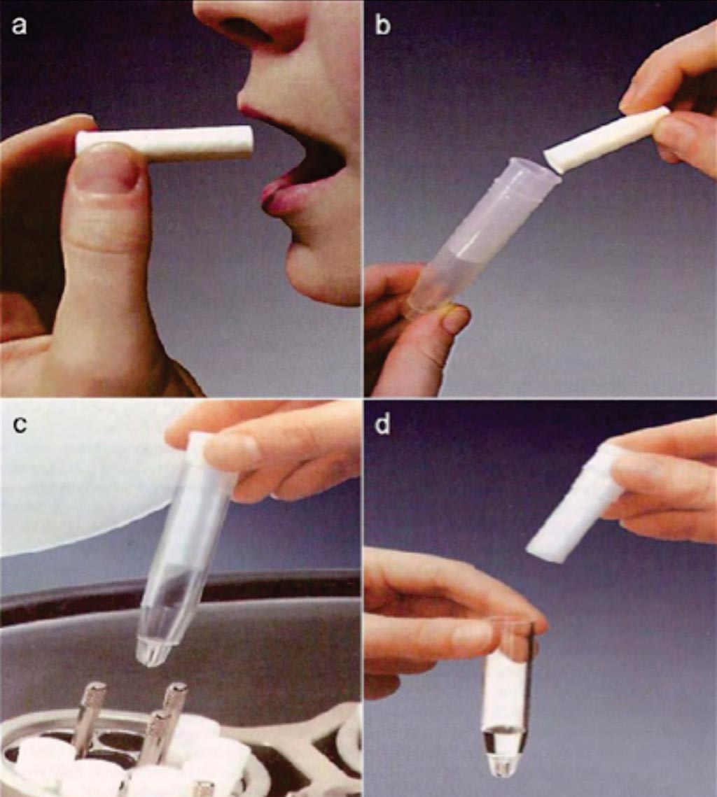 Image: A collection of whole saliva by the Salivette (absorbent) method. (a) Saliva is collected by chewing a cotton wool swab. (b) The swab containing saliva is placed in the tube of Salivette. (c) Centrifugation of the assemblage. (d) Saliva is separated from the swab and is ready for analysis (Photo courtesy of Sarstedt).