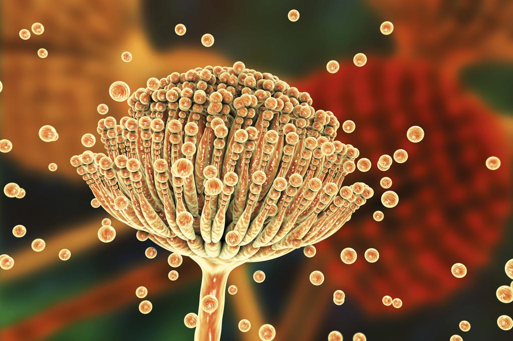 Image: Aspergillus (Photo courtesy of Kateryna Kon / Fotolia.com).