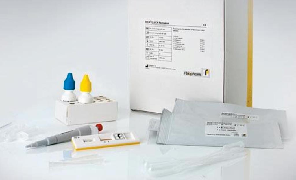 Image: The RIDAQUICK Norovirus test is a quick qualitative immunochromatographic test for determining genogroup 1 (GG I) and genogroup 2 (GG II) noroviruses in stool samples (Photo courtesy of R-Biopharm AG).