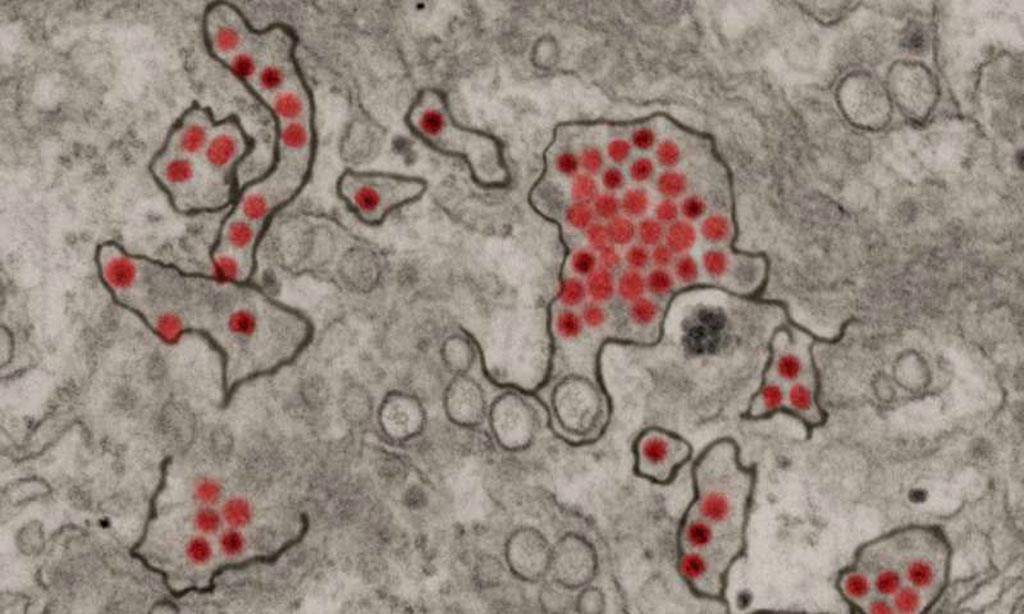 Image: Zika virus particles (red) shown in African green monkey kidney cells (Photo courtesy of the [U.S.] National Institute of Allergy and Infectious Diseases).