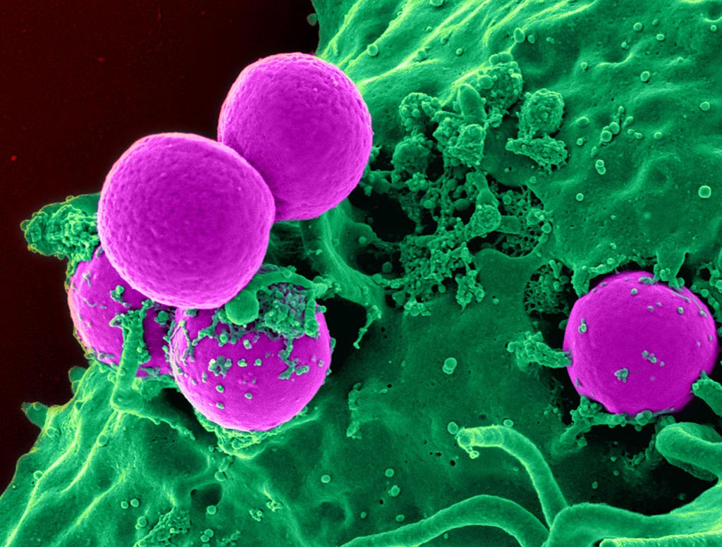 Image: A scanning electron micrograph (SEM) of a human neutrophil ingesting MRSA (Photo courtesy of the U.S. National Institute of Allergy and Infectious Diseases).