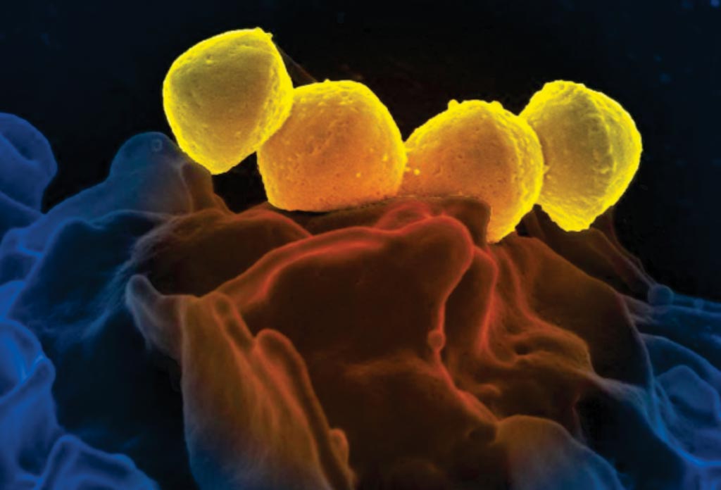 Image: This digitally colorized scanning electron microscopic (SEM) picture depicts four, yellow colored, Group A Streptococcus (GAS), Streptococcus pyogenes bacteria, which were atop the surface of a human white blood cell (WBC), known as a neutrophil (Photo courtesy of the US National Institute of Allergy and Infectious Diseases).