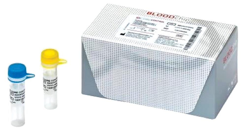 Image: The ID Core XT BLOODchip is a molecular-based assay used in blood transfusion medicine to help determine blood compatibility and could supplement the classical blood match methodology (Photo courtesy of Progenika Biopharma SA).