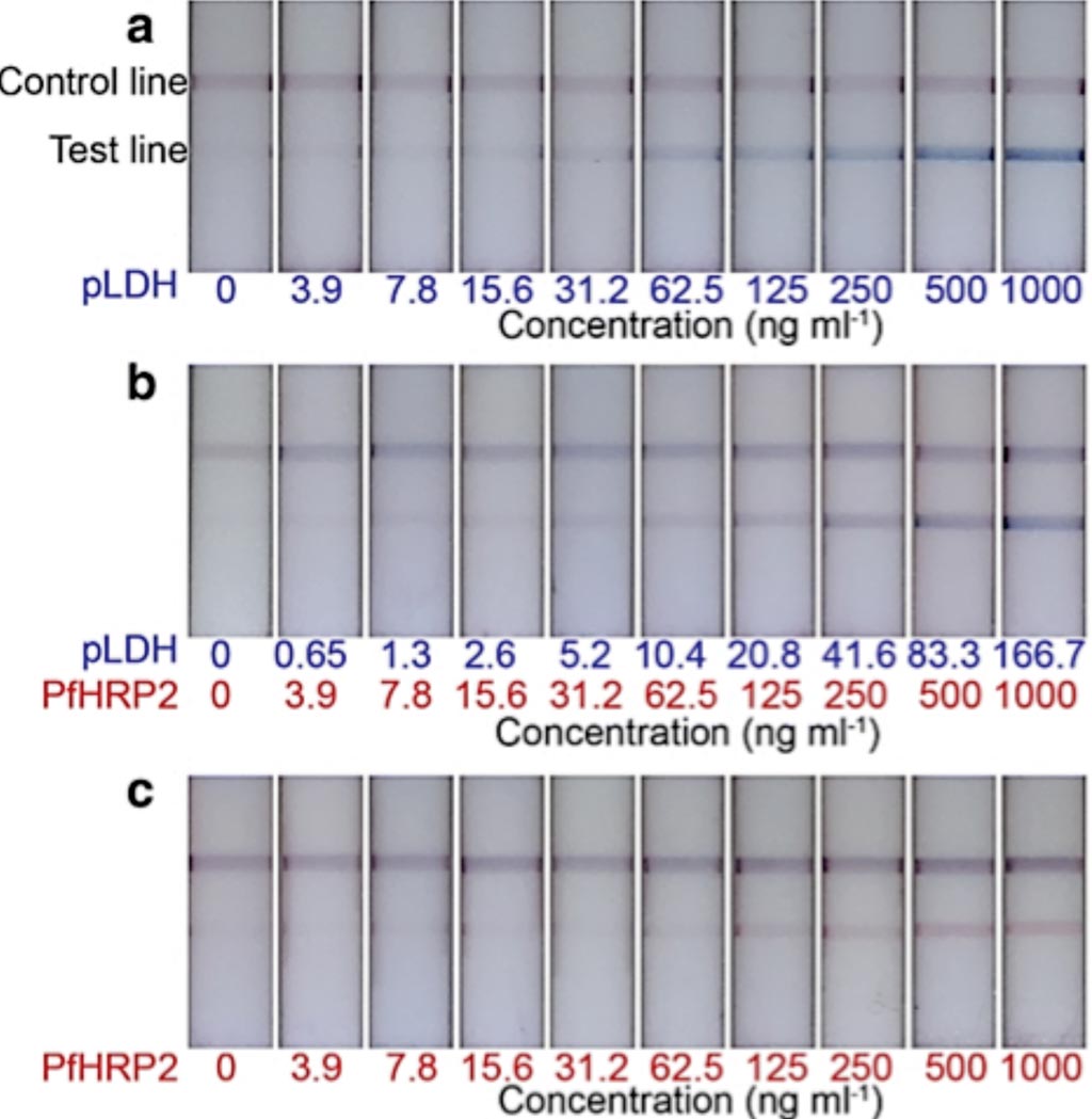 Image: Representative test strips of the two-color LFA. Distinct colors were observed at the test lines, corresponding to a type of antigen, such as a blue test lines for pLDH detection only (Photo courtesy of Cornell University).