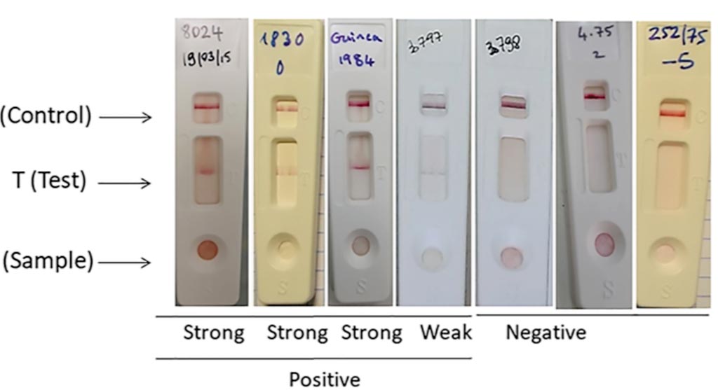 Image: Rift Valley Fever (RVF) lateral flow immunochromatographic (LFT) strip test for the detection of RVF infection using the two selected monoclonal antibodies (Photo courtesy of University of Montpellier).