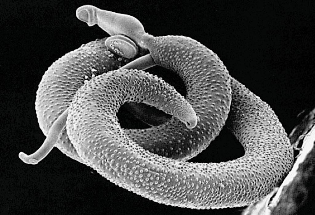Image: Scanning electron micrograph of a pair of Schistosoma mansoni (Photo courtesy of the Davies Laboratory Uniformed Services University).