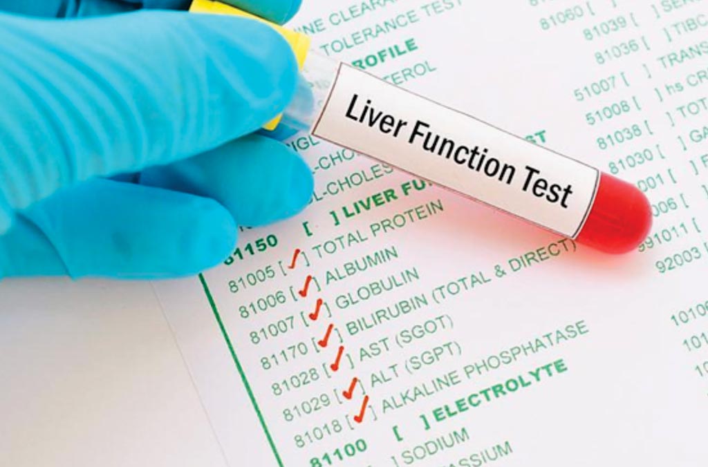 Image: Abnormal serum hepatic enzymes and lipid levels are associated with glycemic control in patients with type 2 diabetes mellitus (Photo courtesy of SRL Diagnostics).