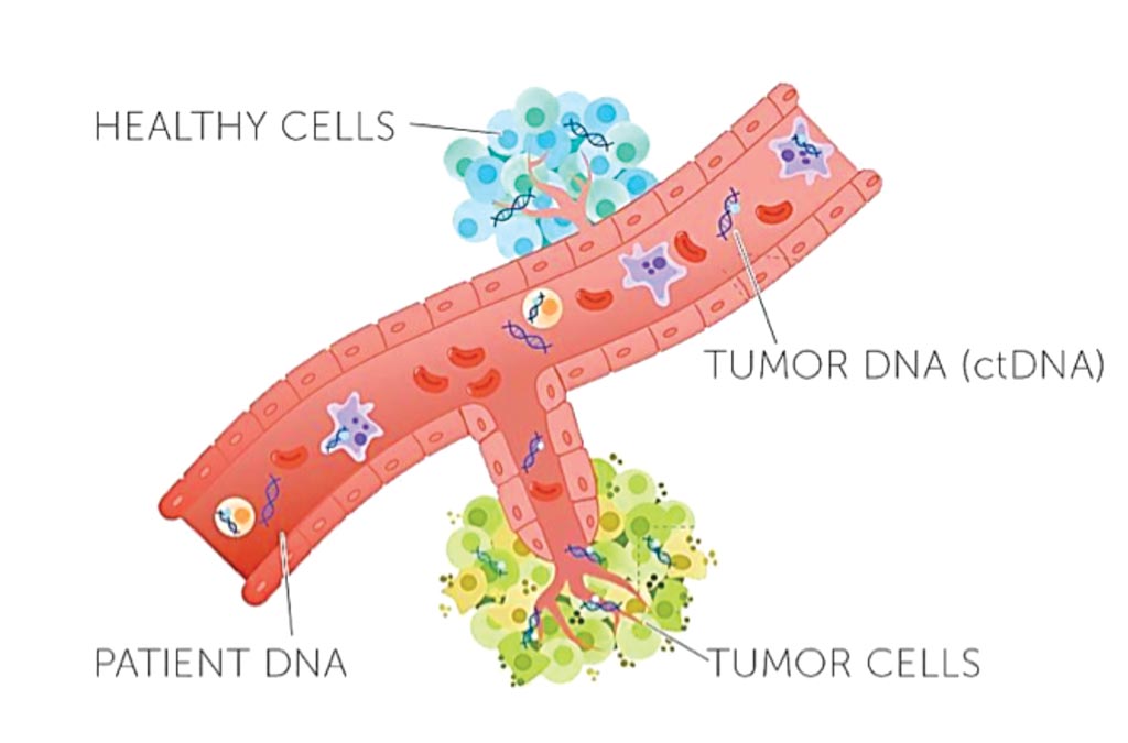 Image: Blood tests can sample circulating DNA cast off by solid tumors, providing information about the tumor and its likely response to treatment without the need for an invasive tumor biopsy (Photo courtesy of Rachel June Wong).