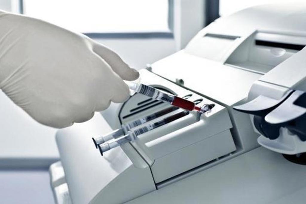 Image: The Bench Top segment is the biggest driver to the global blood gas and electrolyte analyzers market (Photo courtesy of Market Research Business).