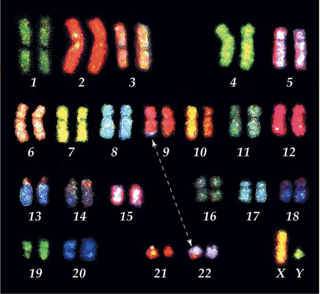 Image: Translocation: a fragment of a chromosome is moved (trans-located) from one chromosome to another and joins a non-homologous chromosome. The balance of genes is still normal (nothing has been gained or lost), but can alter phenotype as it places genes in a new environment (Photo courtesy of Indiana University).