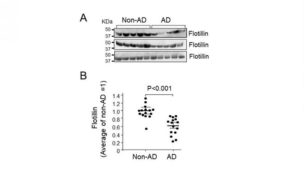 Image: Serum flotillin levels in patients with AD were lower than those in non-AD cases (Photo courtesy of Makoto Michikawa, Nagoya City University)