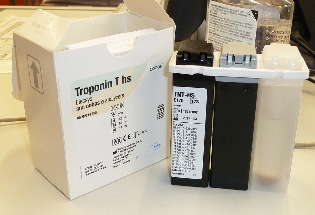 Image: The Elecsys Troponin T-high sensitive (TnT-hs) assay can reduce the time needed to rule-in or rule-out non-ST segment elevation myocardial infarction (NSTEMI) to as little as just one hour (Photo courtesy of Roche).
