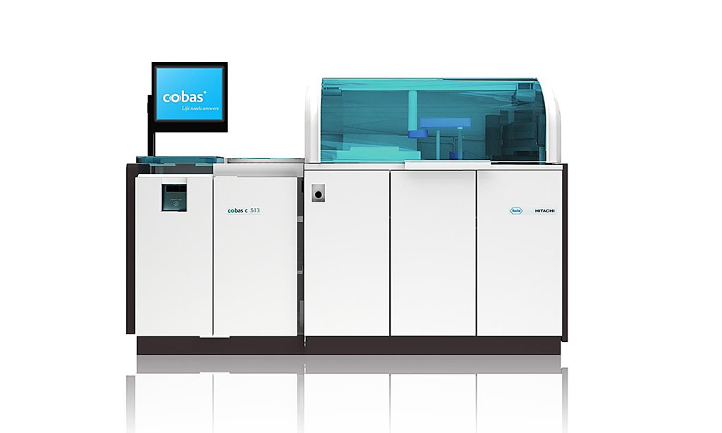 Image: The cobas c 513 analyzer is a dedicated high throughput HbA1c analyzer designed to meet efficiency, throughput and accuracy needs for HbA1c laboratory testing (Photo courtesy of Roche Diagnostics)
