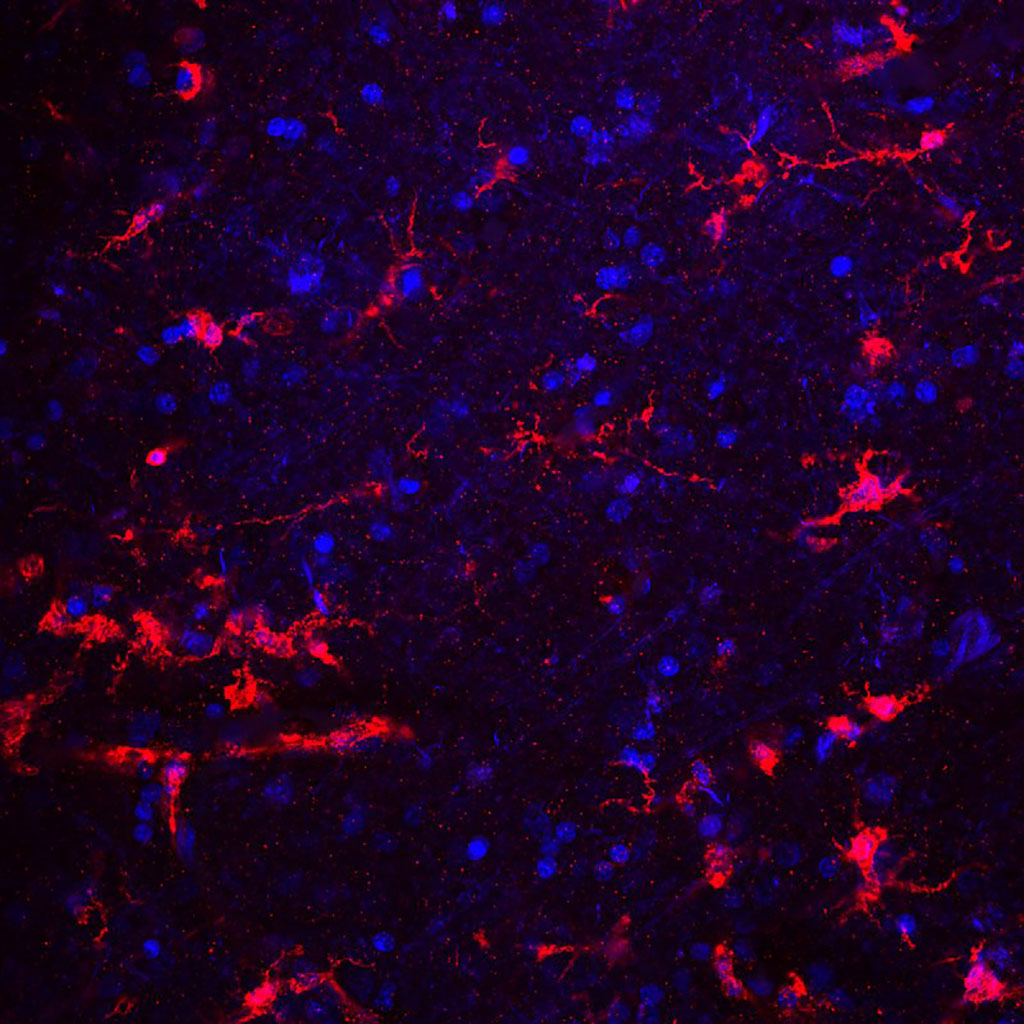 Image: Immunofluorescence image of microglial cells stained red with antibody. DNA shown in blue (Photo courtesy of Wikimedia Commons)