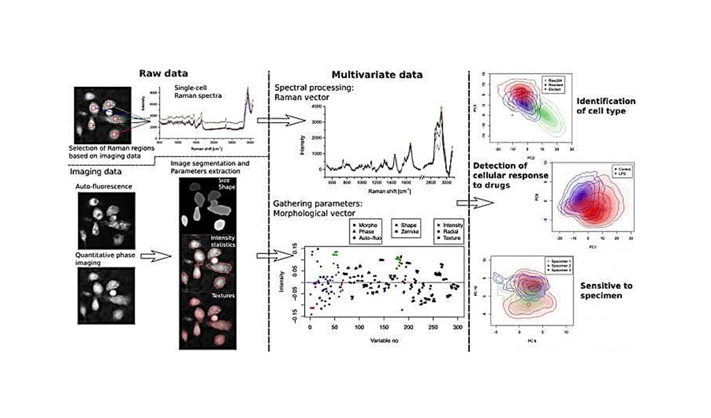 Image: Methods of extracting features from label-free immune cell analysis. Multivariate label-free data, composed of both morphological and spectral parameters, are used to identify high-level features at the single-cell level such as cellular type, response to drugs, as well as response differences between specimens (Photo courtesy of Osaka University)