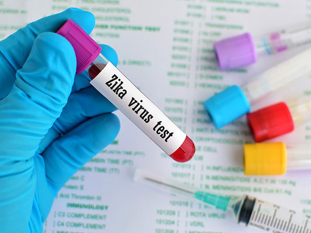 Image: Blood test for Zika MAC-ELISA: Zika Virus IgM Persists 25 Months After Symptom Onset (Photo courtesy of Darren Ellis)