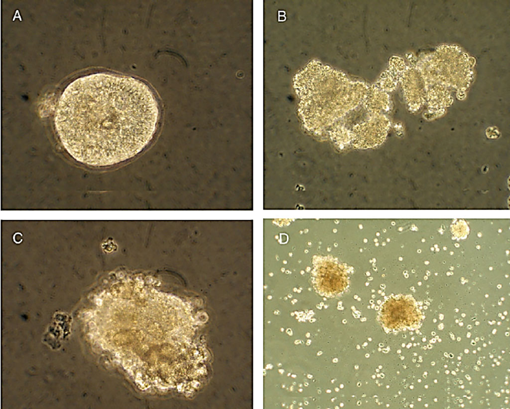 Image: Degree of islet degradation in human pancreatic islets infected with isolates of enteroviruses, and in uninfected controls. (A) Uninfected human islet displayed no degradation of the islets. (B) Islets infected with an Enterovirus isolate three days post infection. (C) Islets infected with a different isolate three days post infection. (D) Islets infected with the same isolate six days post infection (Photo courtesy of Gun Frisk, PhD).