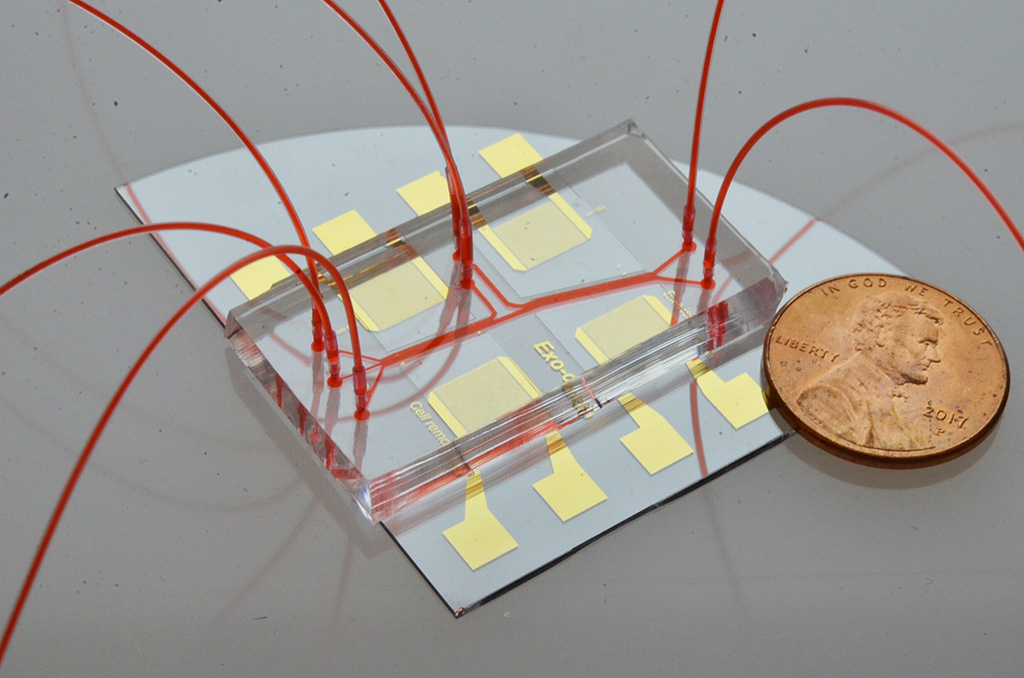 Image: Acoustofluidic exosome isolation chip for salivary exosome isolation. The microfluidic channel is shown by red dye solution and the coin demonstrates the size of the chip. Two pairs of gold interdigital transducers are deposited along the channel, which separates particles according to size (Photo courtesy of The Journal of Molecular Diagnostics)