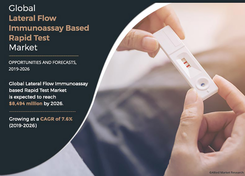 Image: Global Lateral Flow Immunoassay based Rapid Test Market is expected to reach $8,494 million by 2026 (Photo courtesy of Allied Market Research)